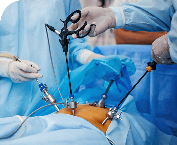 laparoscopic gastrointestinal surgery in mumbai