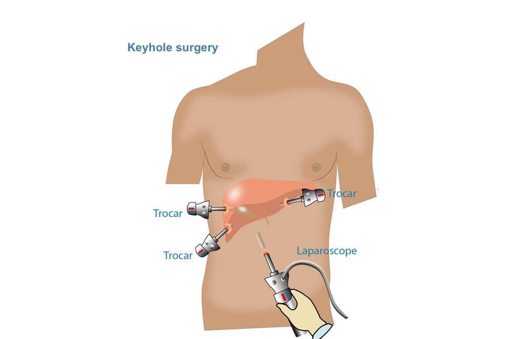 liver infection treatment in mumbai