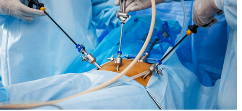 upper gi surgery in mumbai